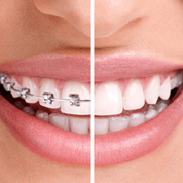 Orthodontics