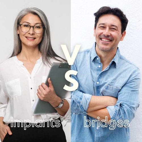 dental implants vs dental bridge