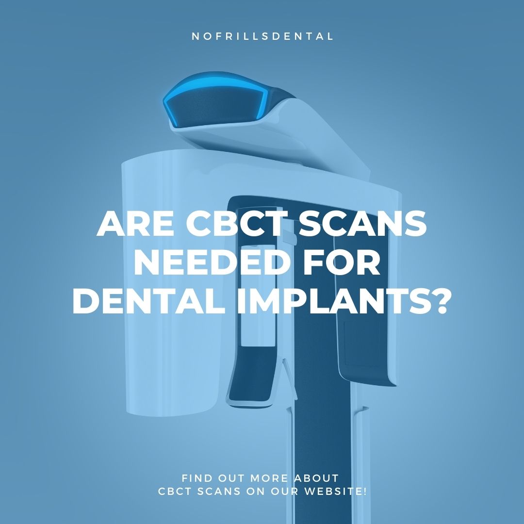 are-cbct-scans-needed-for-dental-implants-nofrills-dental