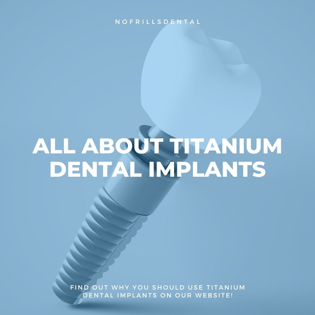 All About Titanium Dental Implants Nofrills Dental