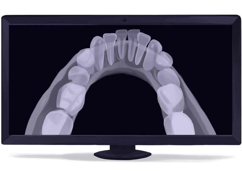 CBCT graphic