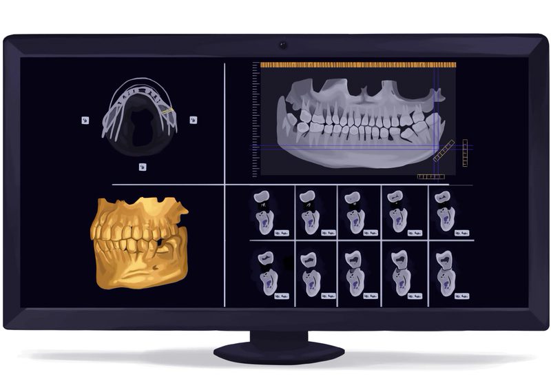 CBCT Graphic