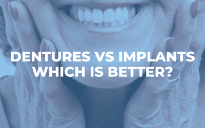 Dental Implants vs Dentures – which is the better option?