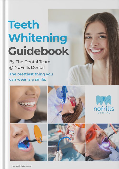 teeth whitening guidebook A4